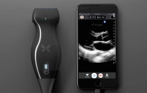 دستگاه Ultra sound آیفون به تشخیص سرطان یک جراح کمک کرد 27 دستگاه Ultra sound