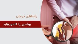 بواسیر